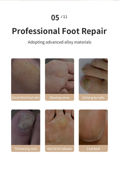 SilkSolePro™- Electric Feet Callus Remover